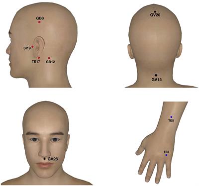 Frontiers | Acupuncture Decreases Amygdala Functional Connectivity In ...